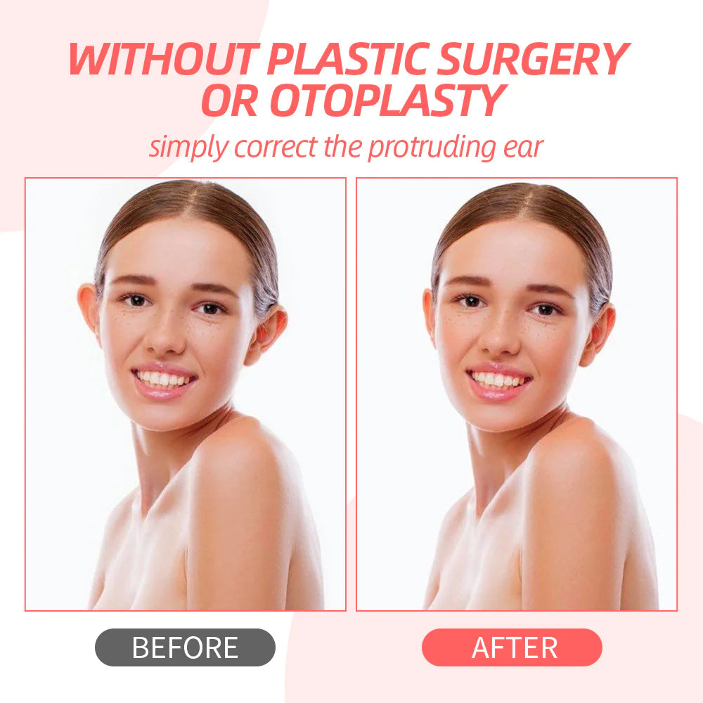 Genvi EarLift™ – Invisible Ear Corrector Pads